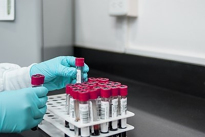  Гърция ще продължи да изисква отрицателен PCR тест поне до 15 септември